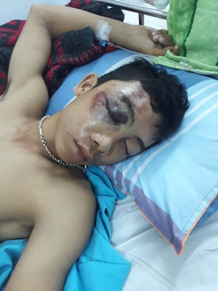 Cầu thay cho một tín hữu thiếu niên bị tai nạn lao động