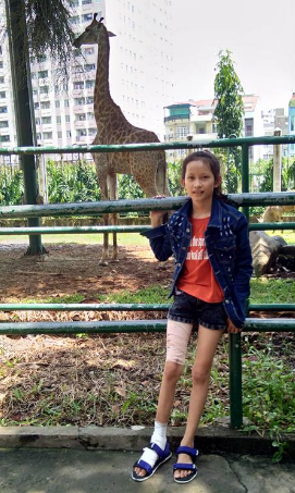 Bé 11 tuổi bị rắn cắn được Chúa cứu một cách diệu kỳ