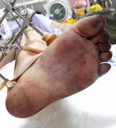 Cập nhật tin tức mới nhất của Mục sư Lê Nguyên Tâm 10g30; 12-6-2017