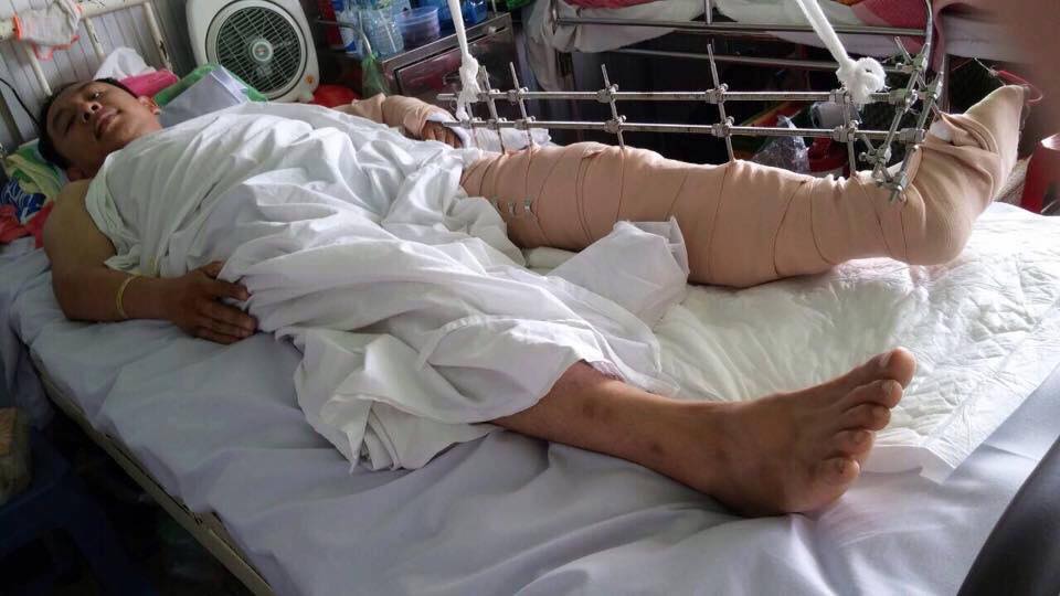 Cập nhật tin về Mục sư Lê Nguyên Tâm – Quản nhiệm Hội Thánh Lâm Đồng