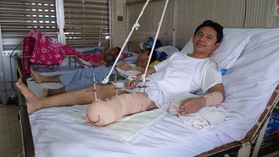 Mục sư Lê Nguyên Tâm đã được phẫu thuật ghép da