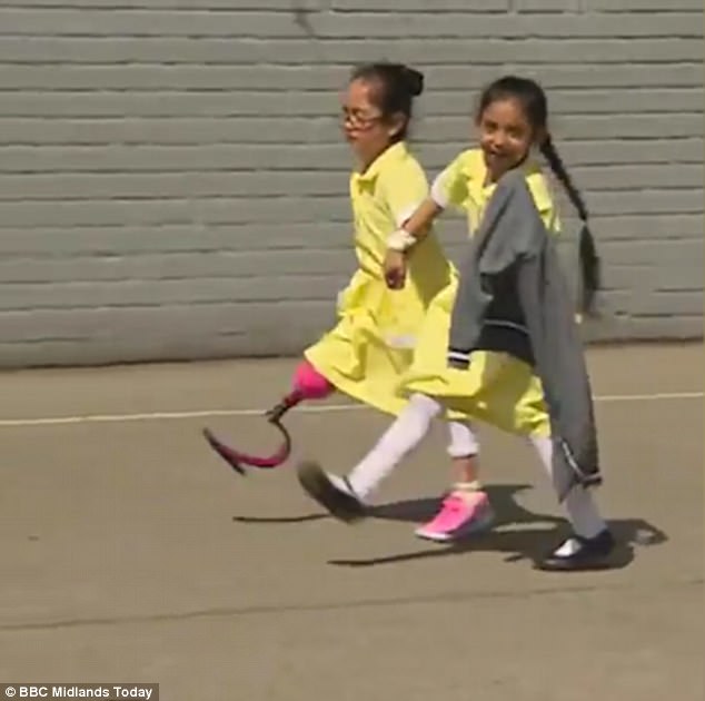 Cô bé một chân có thể chạy được rồi!