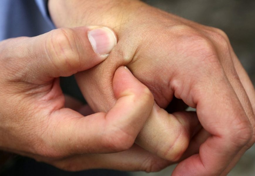 Cấy ghép con chip, sách Khải Huyền đã ứng nghiệm!